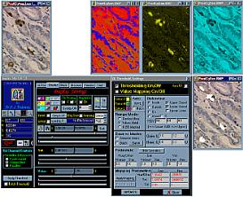 HSV Thresholding with BiaQIm